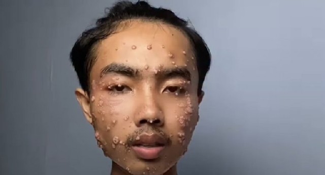 .